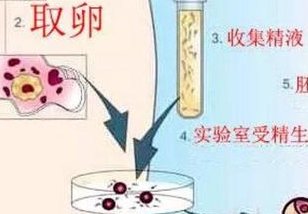 老公逆行射精可以做试管婴儿吗？